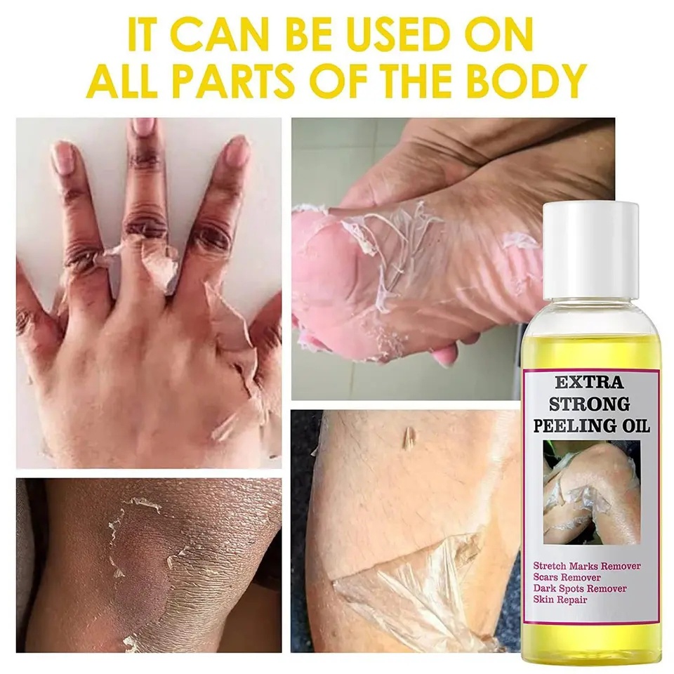 EXTRA STRONG PEELING OIL
